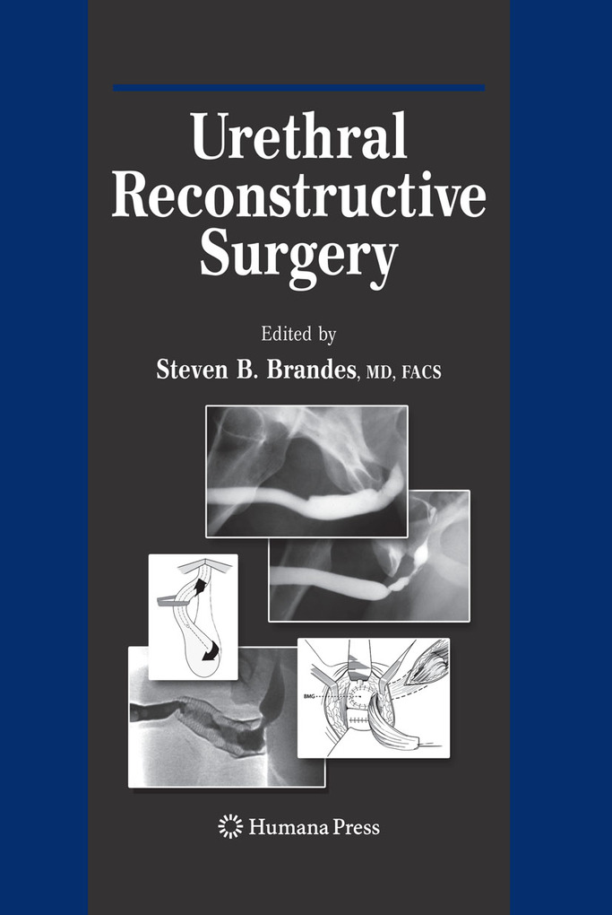Urethral Reconstructive Surgery als eBook von - Humana Press
