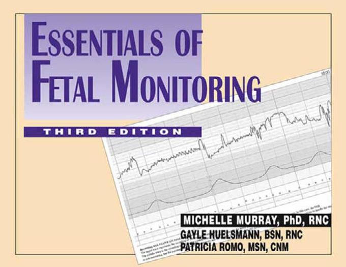 Essentials of Fetal Monitoring als eBook von Michelle Murray, Gayle Huelsmann, Patricia Romo - Springer Publishing