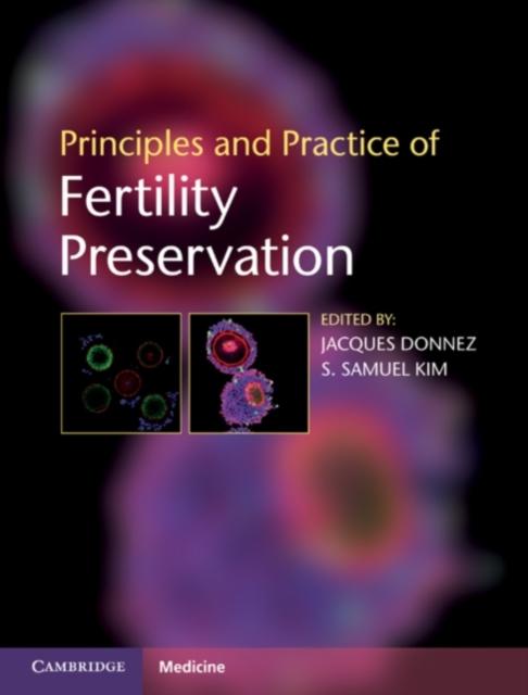 Principles and Practice of Fertility Preservation als eBook von - Cambridge University Press