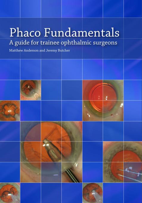 Phaco Fundamentals als eBook von Matthew Anderson, Jeremy Butcher - Troubador Publishing