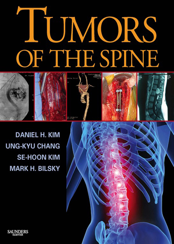 Tumors of the Spine E-Book als eBook von Daniel H. Kim, Ung-kyu Chang, Se-Hoon Kim, Mark H. Bilsky - Elsevier Health Sciences
