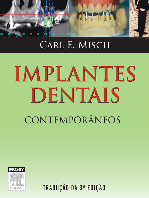 Implantes Dentais Contemporâneos als eBook von Carl Misch - Elsevier Health Sciences