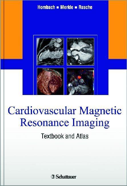 Cardiovascular Magnetic Resonance Imaging als eBook von - Schattauer GmbH, Verlag für Medizin und Naturwissenschaften