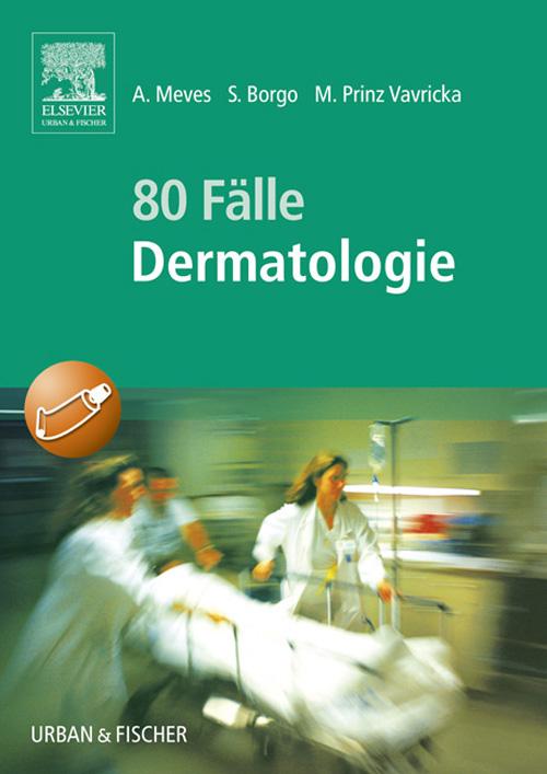 80 FÃ¤lle Dermatologie Alexander Meves Author