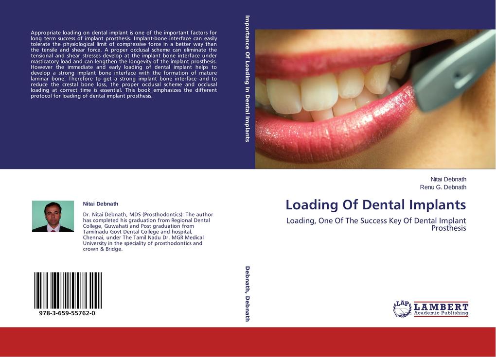 Loading Of Dental Implants als Buch von Nitai Debnath, Renu G. Debnath - LAP Lambert Academic Publishing