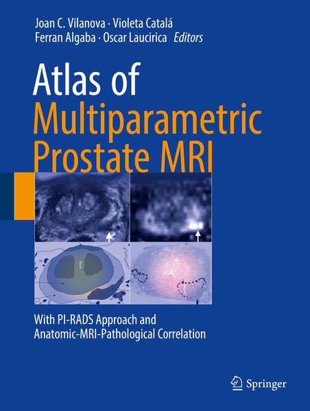 Atlas of Multiparametric Prostate MRI: With PI-RADS Approach and Anatomic-MRI-Pathological Correlation