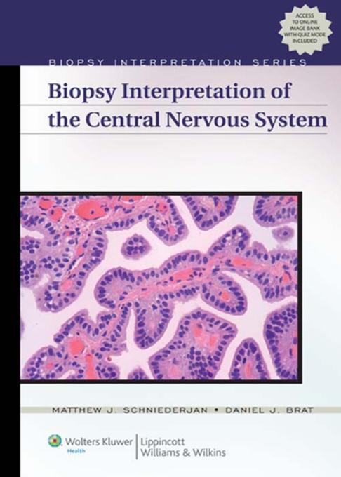 Biopsy Interpretation of the Central Nervous System als eBook von Matthew J. Schniederjan - Wolters Kluwer Health