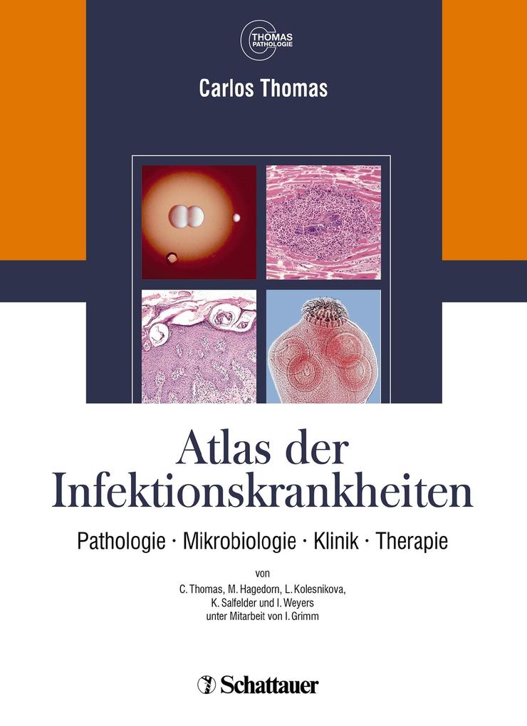 Atlas der Infektionskrankheiten - Carlos Thomas/ Annette Cecetka-Thomas/ Renate Woicichowski