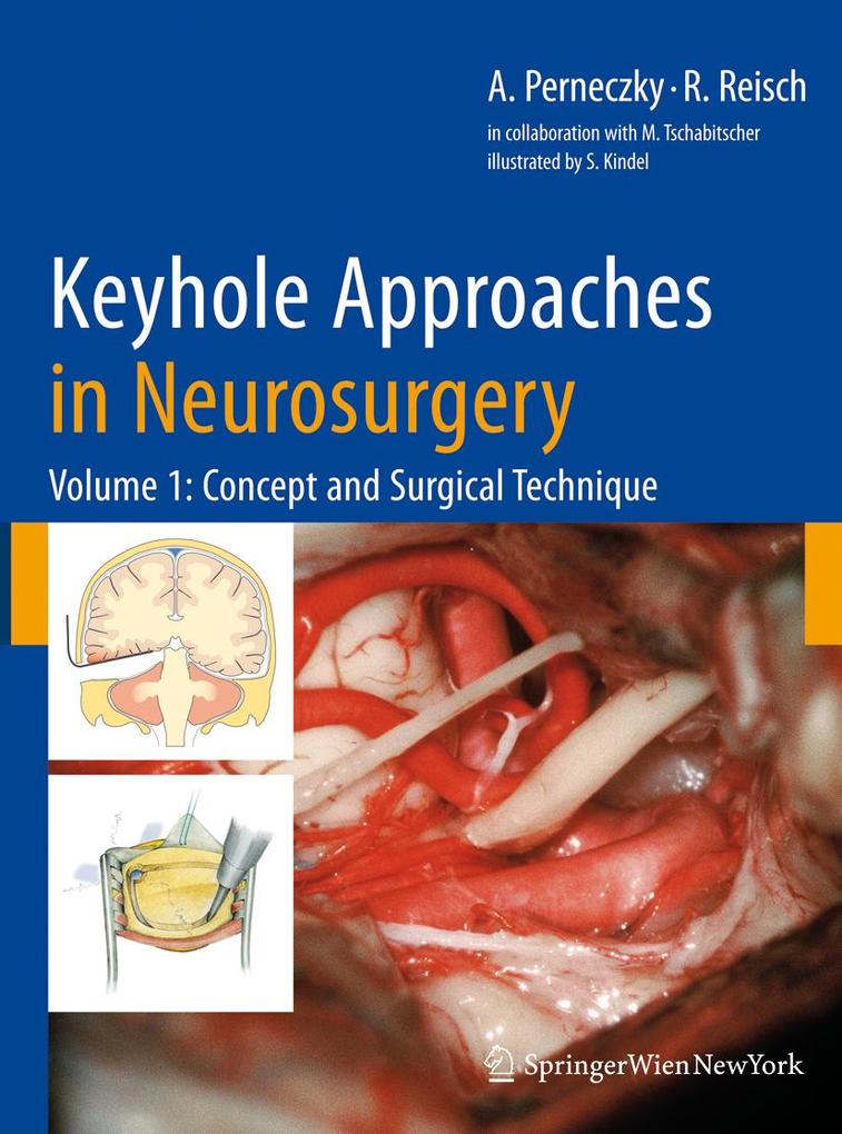 Keyhole Approaches in Neurosurgery - Axel Perneczky/ Robert Reisch