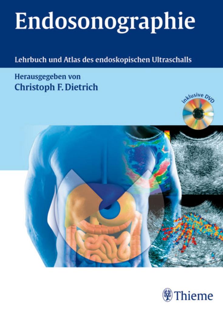 Endosonographie - Christoph Frank Dietrich