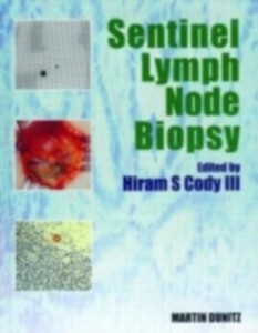 Sentinel Lymph Node Biopsy als eBook von - CRC Press