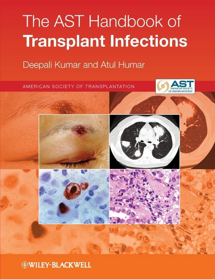 The AST Handbook of Transplant Infections als eBook von Deepali Kumar, Atul Humar - John Wiley & Sons