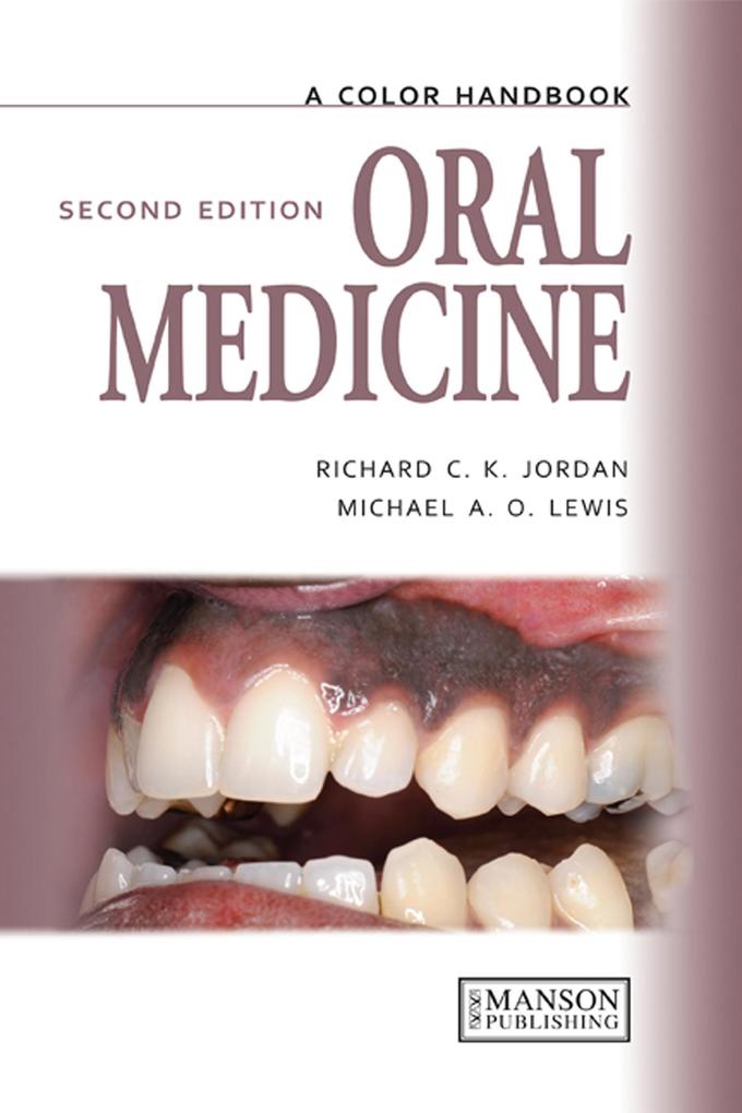 Oral Medicine - Michael Lewis/ Richard Jordan