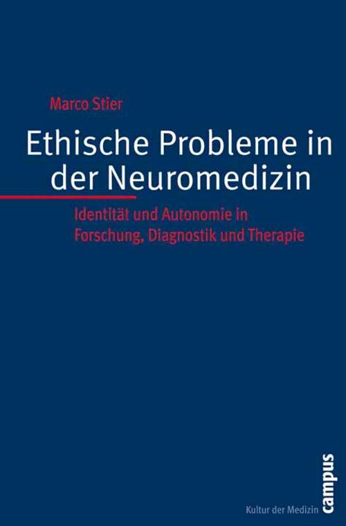 Ethische Probleme in der Neuromedizin - Marco Stier