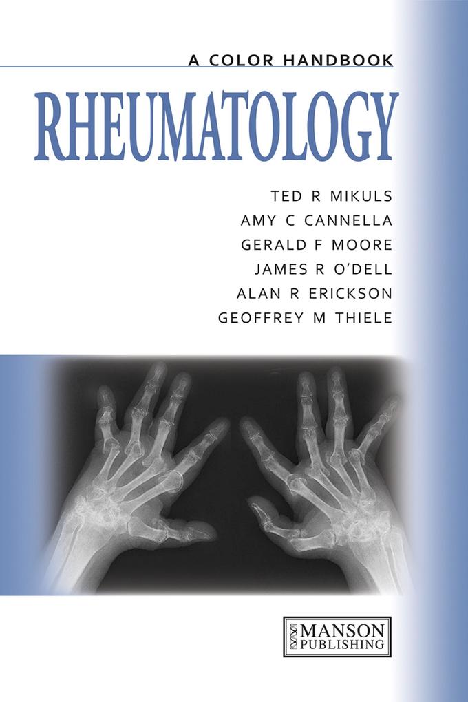 Rheumatology - Amy Cannella/ Alan Erikson/ Ted Mikuls/ Gerald Moore/ James O'Dell