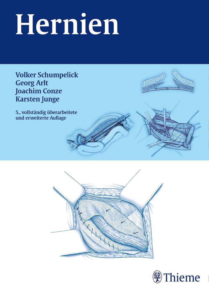 Thieme Hernien, Fachbücher Von Volker Schumpelick, Klaus Joachim Conze, Karsten Junge, Georg Arlt - Bild 4