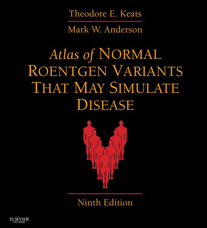 Atlas of Normal Roentgen Variants That May Simulate Disease E-Book - Theodore E. Keats/ Mark W. Anderson