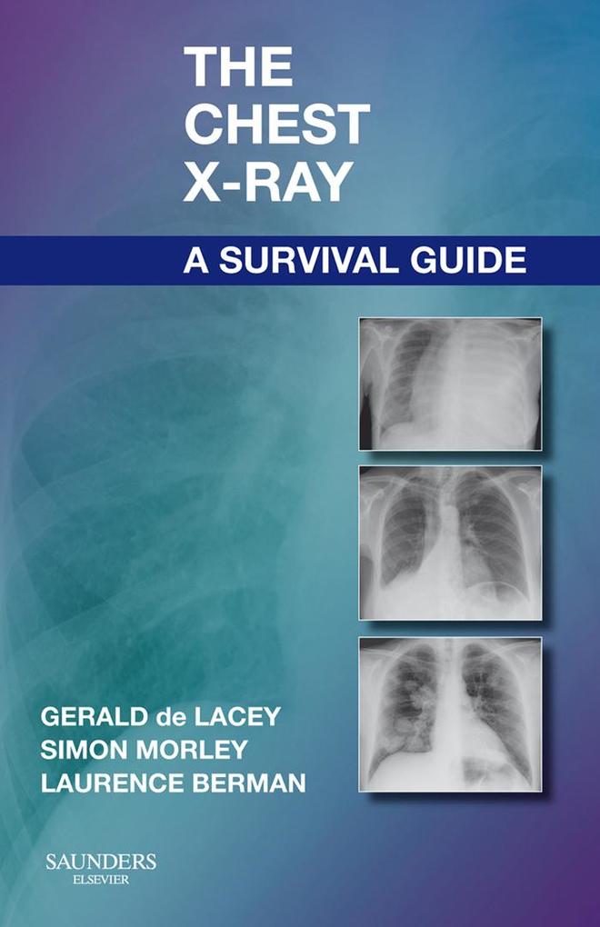 The Chest X-Ray: A Survival Guide - Gerald de Lacey/ Simon Morley/ Laurence Berman