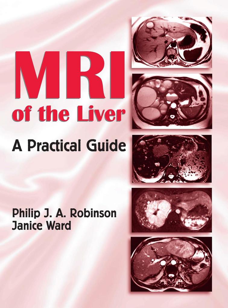 MRI of the Liver - Philip J. A. Robinson/ Janice Ward