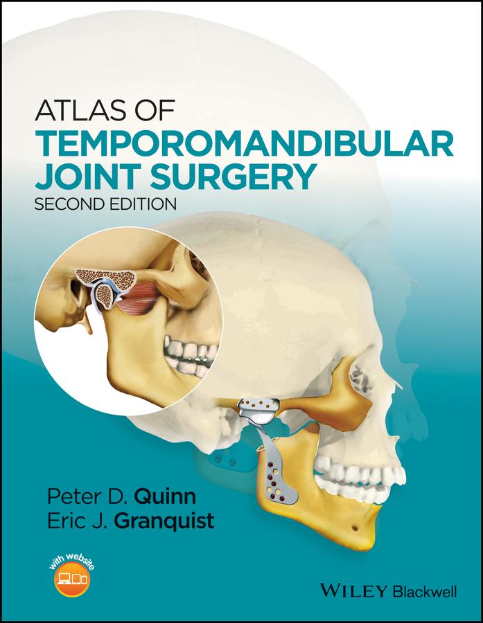 Atlas of Temporomandibular Joint Surgery