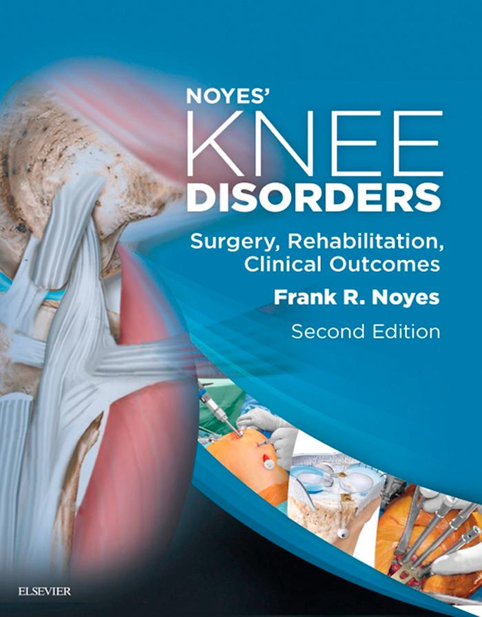 Noyes' Knee Disorders: Surgery Rehabilitation Clinical Outcomes E-Book - Frank R. Noyes