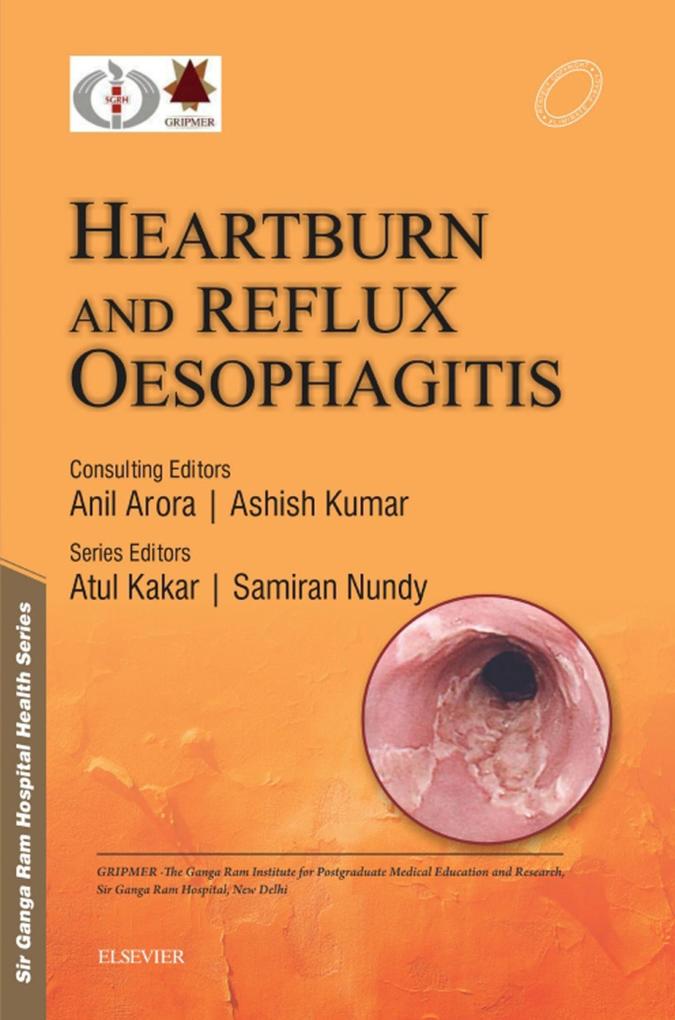 Sir Ganga Ram Hospital Health Series: Heartburn and Reflux Oesophagitis - e-book - Samiran Nundy