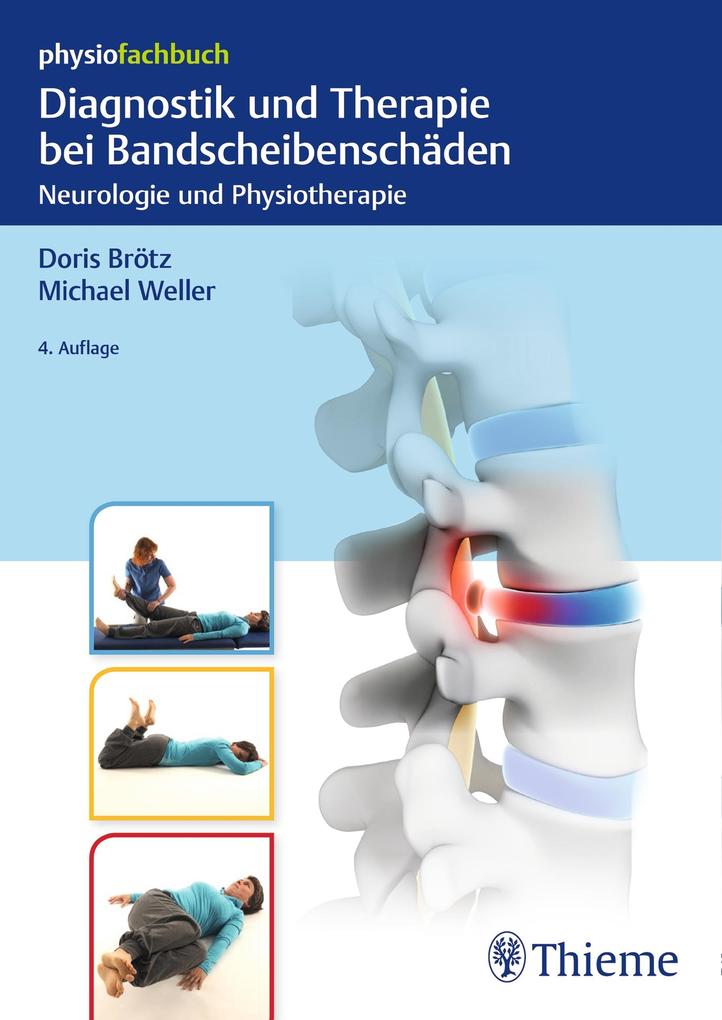 Diagnostik und Therapie bei Bandscheibenschäden - Doris Brötz/ Michael Weller