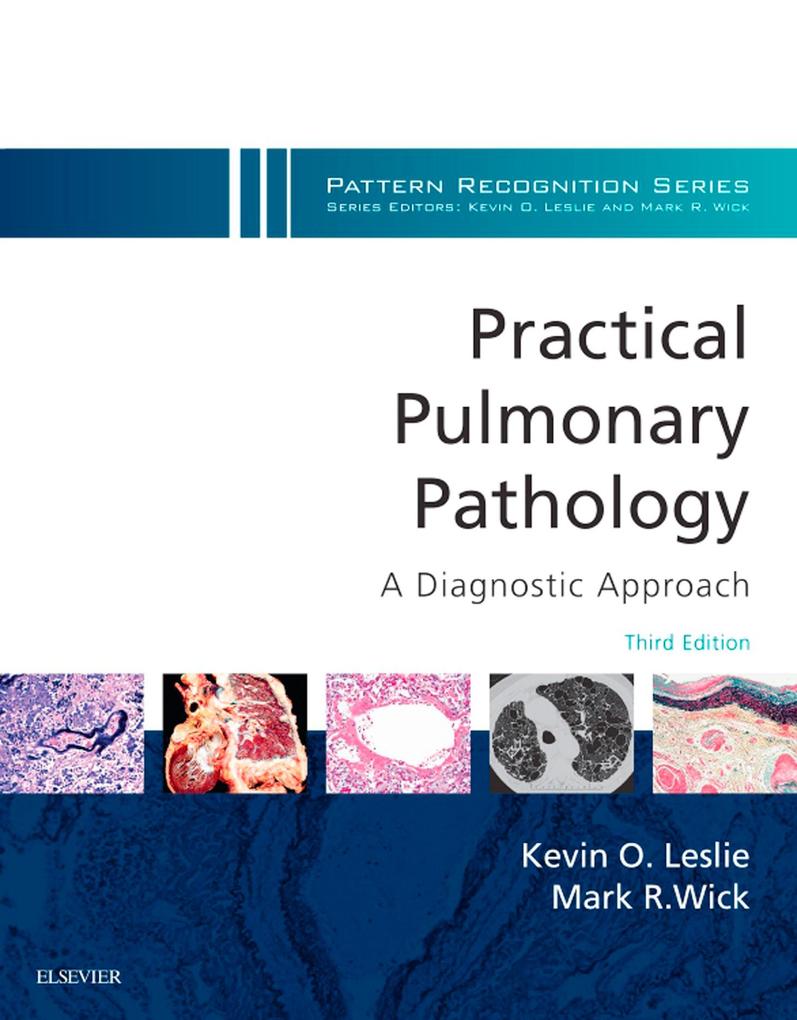 Practical Pulmonary Pathology: A Diagnostic Approach E-Book - Kevin O. Leslie/ Mark R. Wick/ Maxwell L. Smith