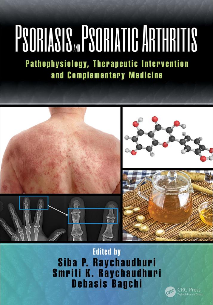 Psoriasis and Psoriatic Arthritis als eBook von - Taylor & Francis Ltd.
