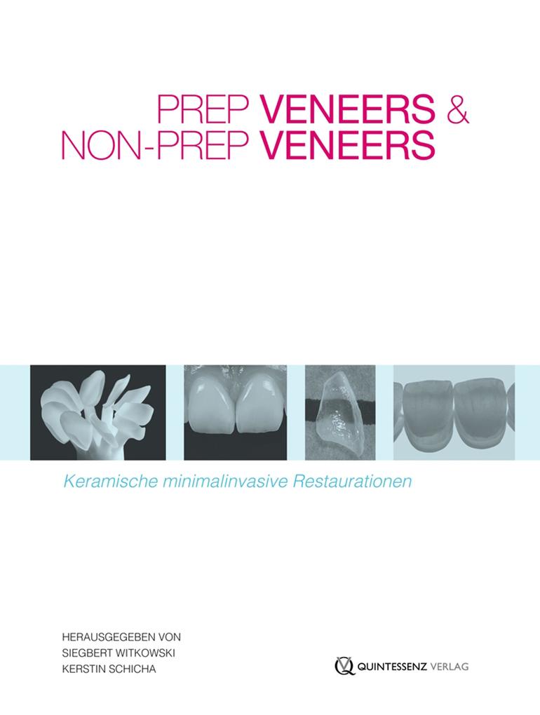 Prep Veneers und Non-Prep Veneers - Kerstin Schicha/ Siegbert Witkowski