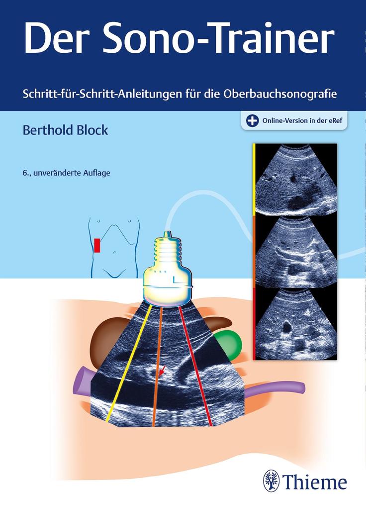 Der Sono-Trainer: Schritt-für-Schritt-Anleitungen für die Oberbauchsonografie - Bild 6
