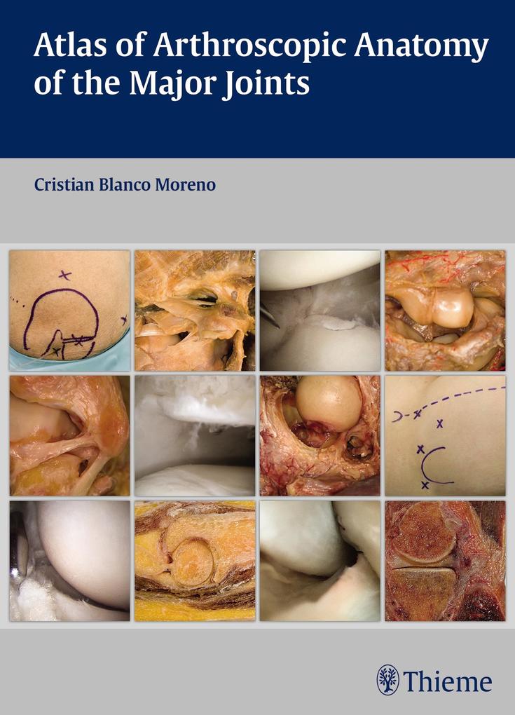 Atlas of Arthroscopic Anatomy of the Major Joints - Cristian Blanco Moreno