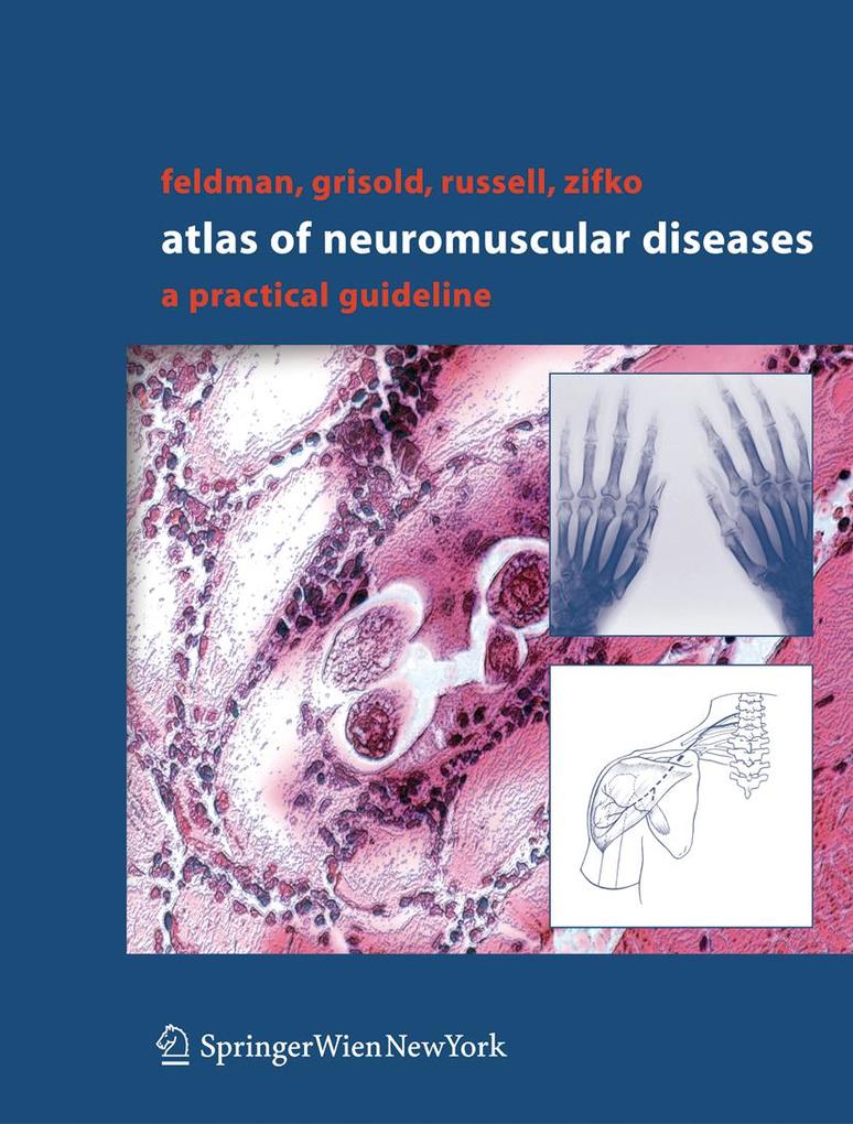 Atlas of Neuromuscular Diseases - Eva L. Feldman/ Wolfgang Grisold/ James W. Russell/ Udo A. Zifko