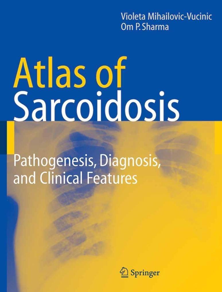 Atlas of Sarcoidosis - Om P. Sharma/ Violeta Mihailovic-Vucinic